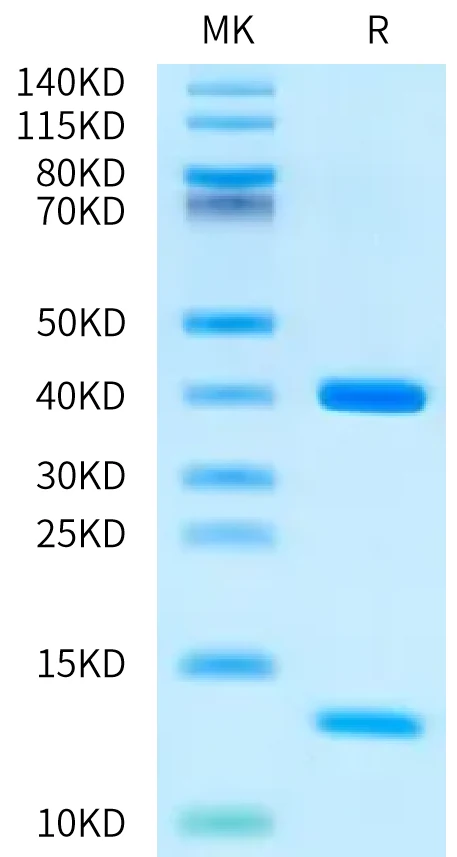 WT1-HB001 Bis-Tris-PAGE-white result