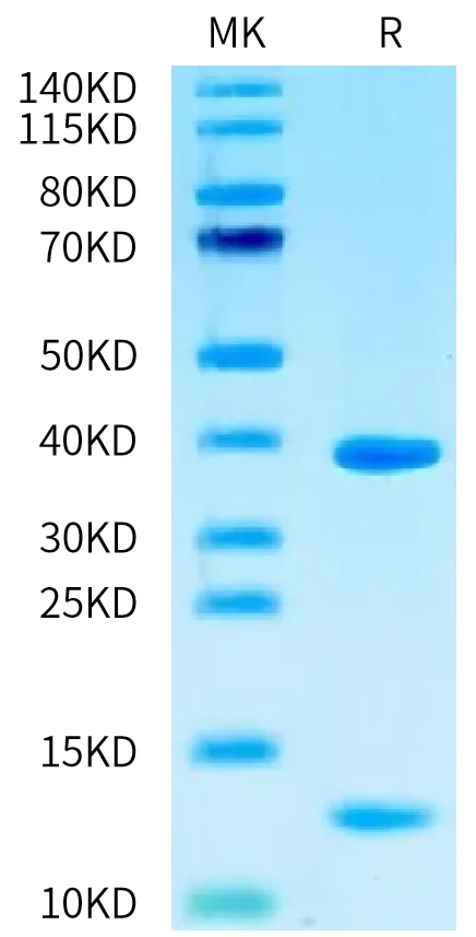 WT1-HP001 Bis-Tris-PAGE-white result